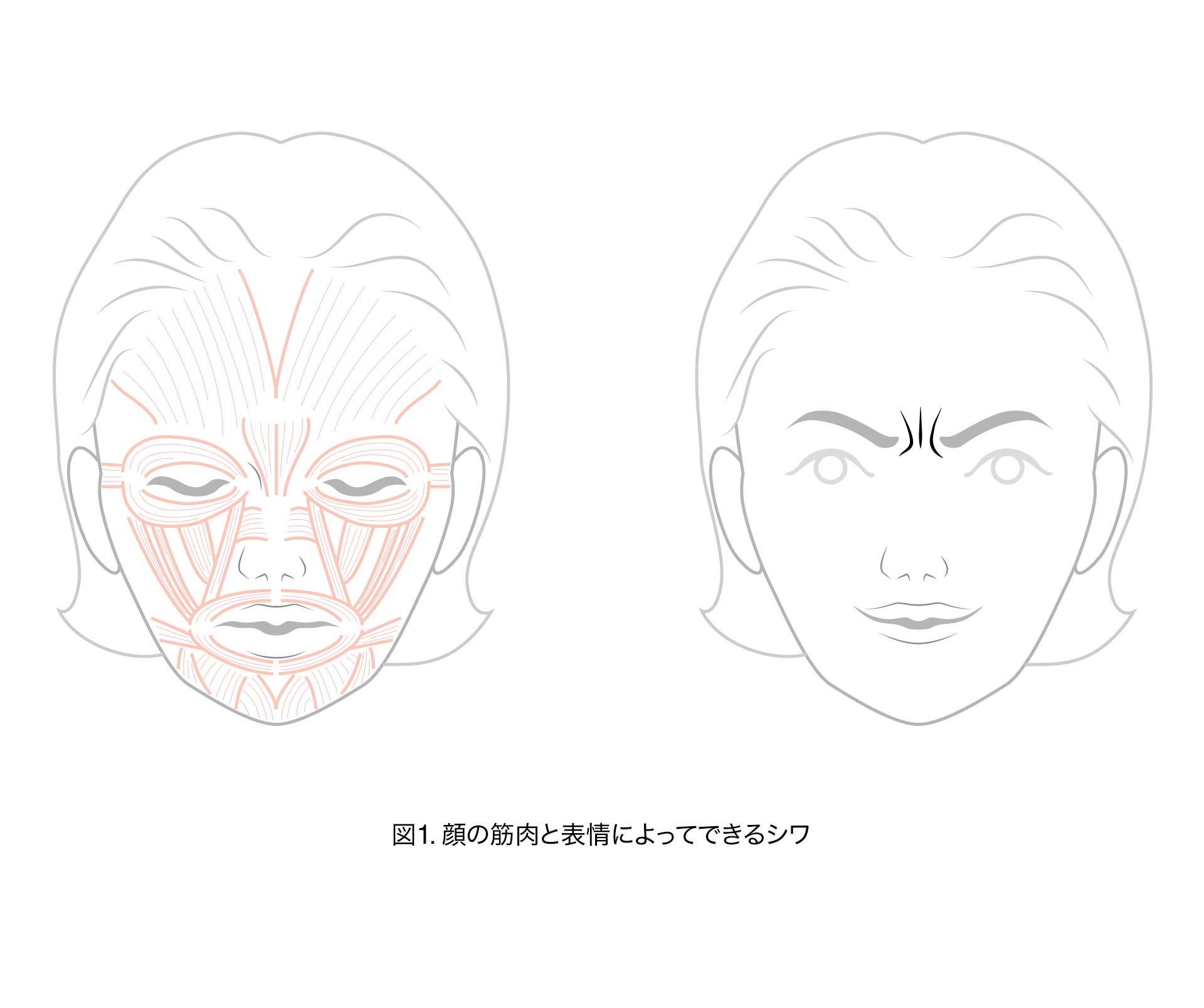 図1.顔の筋肉と表情によってできるシワ